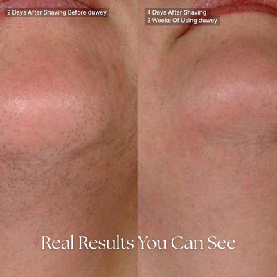 duwey™ Cyperus Rotundus Oil