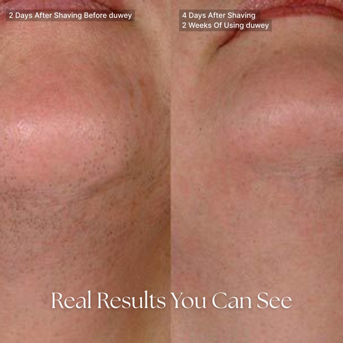 duwey™ Cyperus Rotundus Oil