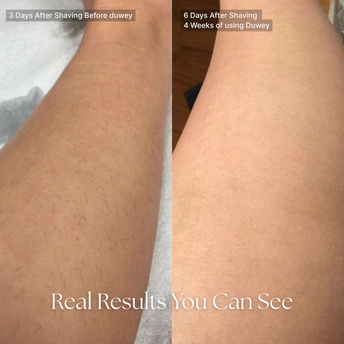 duwey™ Cyperus Rotundus Oil