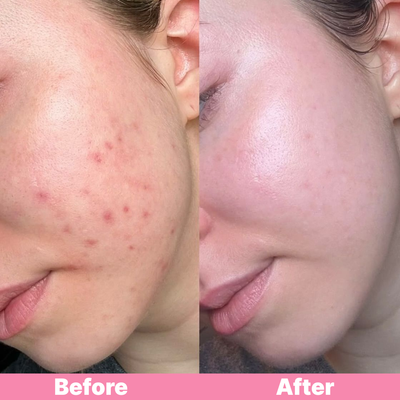 duwey™ Skin Care Tape