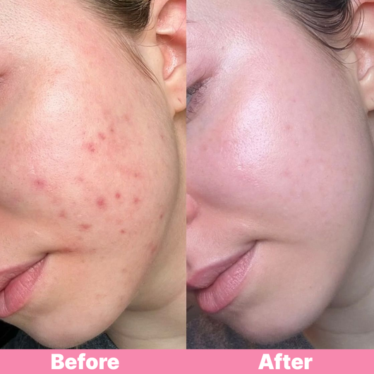 duwey™ Skin Care Tape