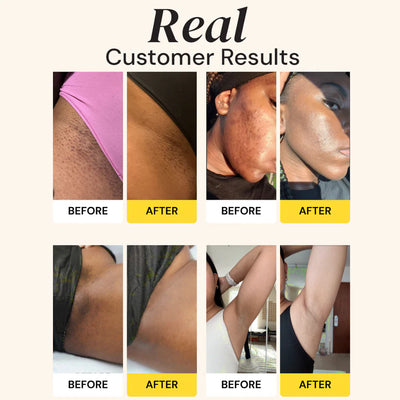 duwey™ Turmeric Kojic Acid Body Wash